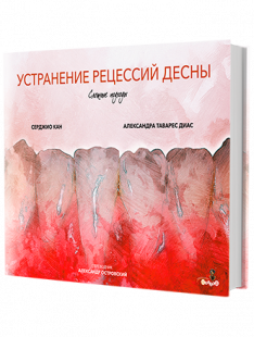 Устранение рецессий десны