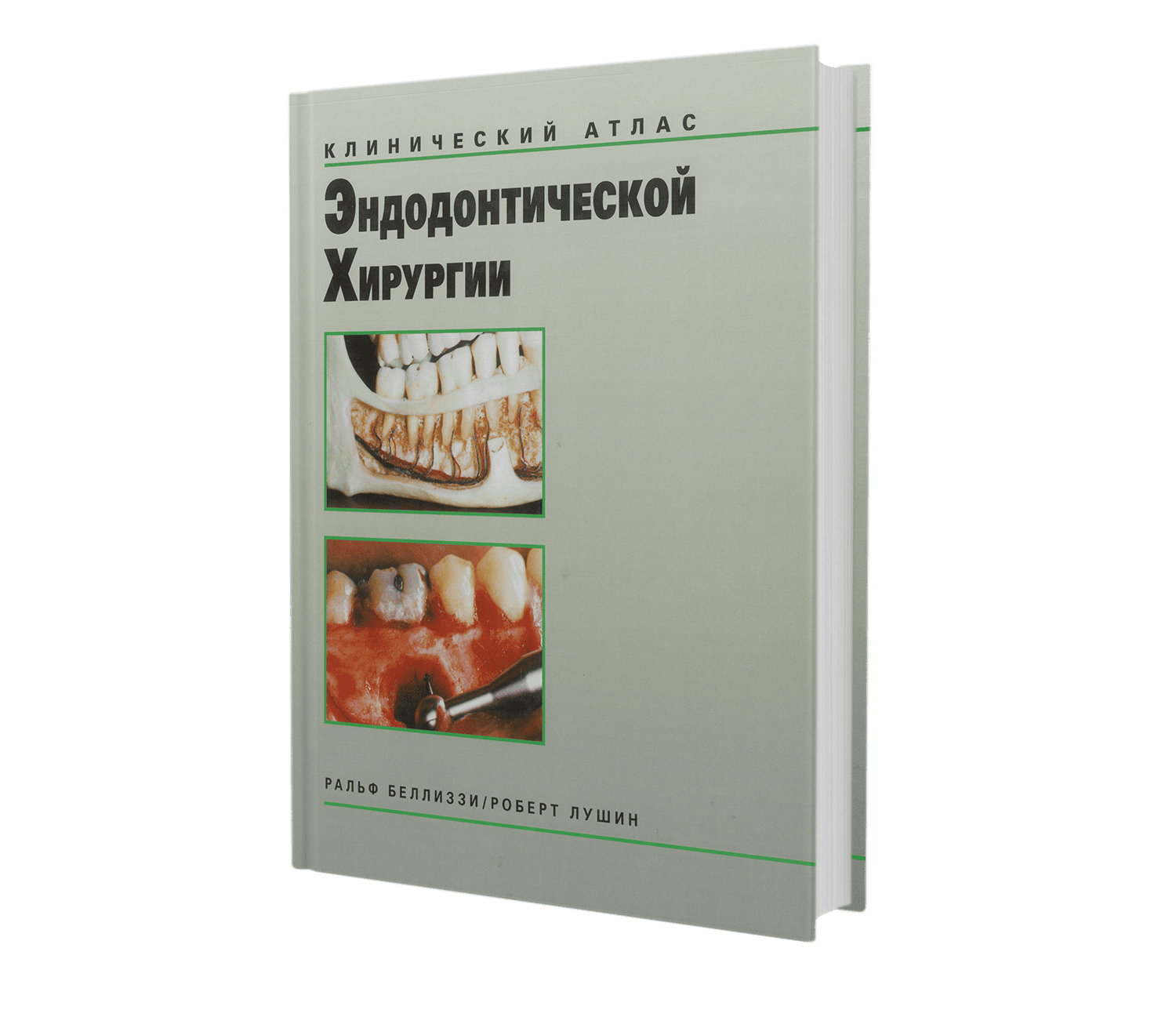 Клинический атлас эндодонтической хирургии